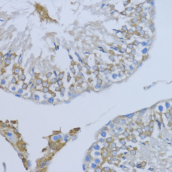 Immunohistochemistry of paraffin-embedded Rat testis using NRG4 Polyclonal Antibody at dilution of  1:200 (40x lens).