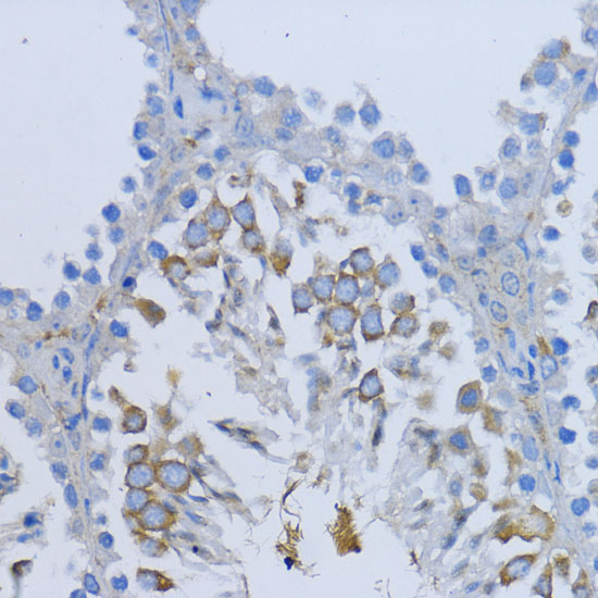 Immunohistochemistry of paraffin-embedded Mouse testis using NRG4 Polyclonal Antibody at dilution of  1:200 (40x lens).