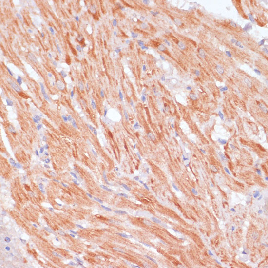 Immunohistochemistry of paraffin-embedded Rat heart using Caspase-9 Polyclonal Antibody at dilution of  1:100 (40x lens).