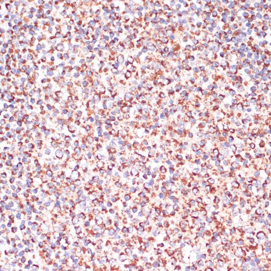 Immunohistochemistry of paraffin-embedded Human tonsil using Caspase-9 Polyclonal Antibody at dilution of  1:100 (40x lens).