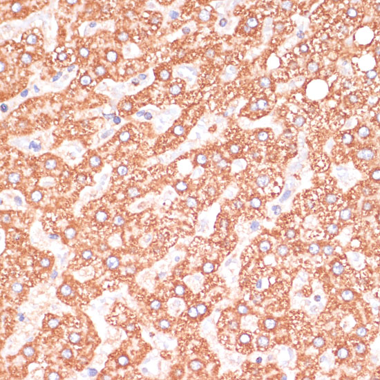 Immunohistochemistry of paraffin-embedded Human liver using Caspase-9 Polyclonal Antibody at dilution of  1:100 (40x lens).