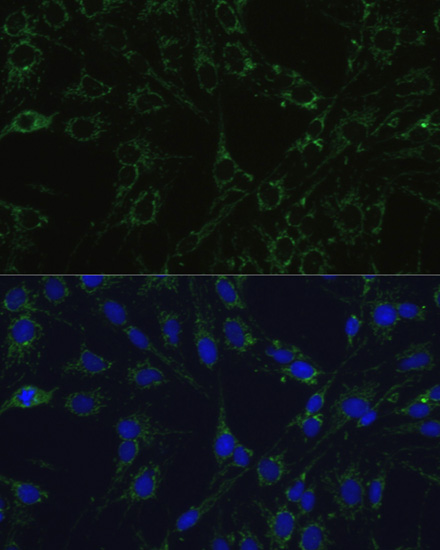 Immunofluorescence analysis of C6 cells using COX5B Polyclonal Antibody at dilution of  1:100. Blue: DAPI for nuclear staining.