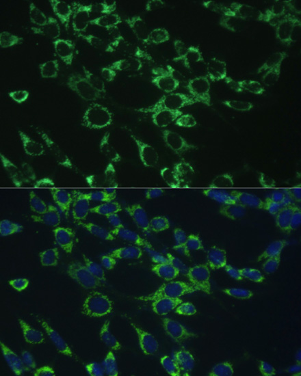 Immunofluorescence analysis of NIH-3T3 cells using COX5B Polyclonal Antibody at dilution of  1:100. Blue: DAPI for nuclear staining.