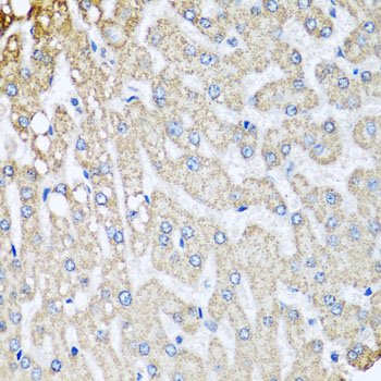 Immunohistochemistry of paraffin-embedded Human liver damage using COX5B Polyclonal Antibody at dilution of  1:100 (40x lens).