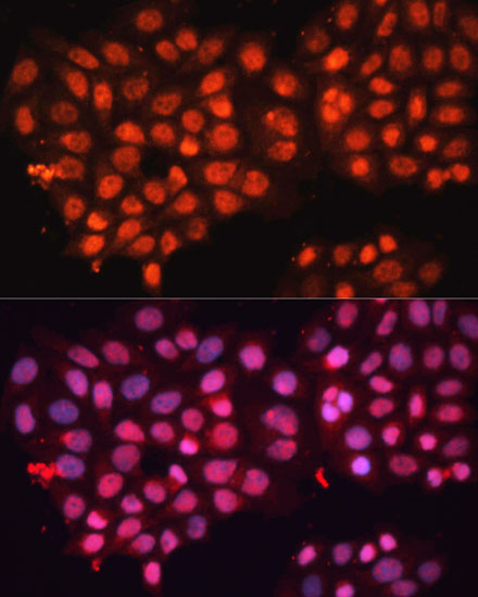 Immunofluorescence analysis of HeLa cells using ABCB8 Polyclonal Antibody at dilution of  1:100 (40x lens). Blue: DAPI for nuclear staining.