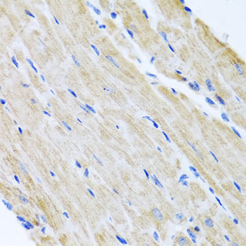 Immunohistochemistry of paraffin-embedded Mouse heart using ABCB8 Polyclonal Antibody at dilution of  1:100 (40x lens).