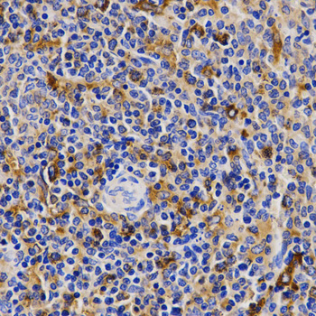 Immunohistochemistry of paraffin-embedded Rat spleen using CDK20 Polyclonal Antibody at dilution of  1:200 (40x lens).