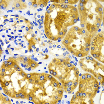 Immunohistochemistry of paraffin-embedded Human kidney using CDK20 Polyclonal Antibody at dilution of  1:100 (40x lens).