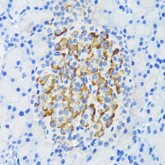 Immunohistochemistry of paraffin-embedded Rat pancreatic islet using DLK1 Polyclonal Antibody at dilution of  1:200 (40x lens).