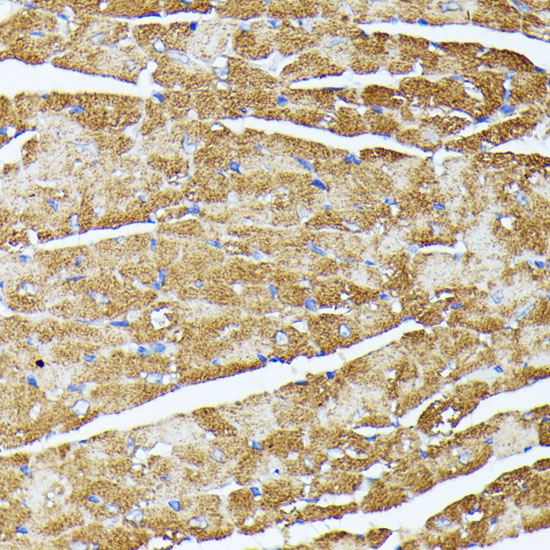 Immunohistochemistry of paraffin-embedded Mouse heart using TRAP1 Polyclonal Antibody at dilution of  1:100 (40x lens).