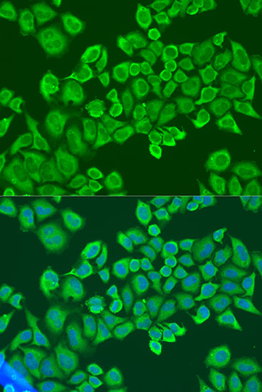 Immunofluorescence analysis of U2OS cells using IGF2BP2 Polyclonal Antibody at dilution of  1:100. Blue: DAPI for nuclear staining.