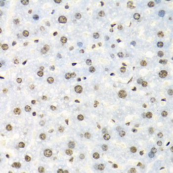 Immunohistochemistry of paraffin-embedded Mouse liver using IGF2BP2 Polyclonal Antibody at dilution of  1:100 (40x lens).