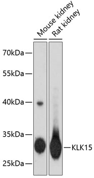 Western blot analysis of extracts of various cell lines using KLK15 Polyclonal Antibody at dilution of 1:3000.