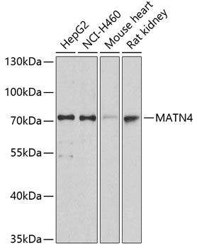 Western blot analysis of extracts of various cell lines using MATN4 Polyclonal Antibody at dilution of 1:3000.