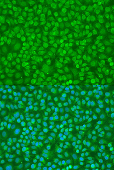 Immunofluorescence analysis of U2OS cells using PTPN11 Polyclonal Antibody at dilution of  1:100. Blue: DAPI for nuclear staining.