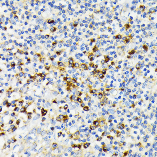 Immunohistochemistry of paraffin-embedded Human tonsil using USO1 Polyclonal Antibody at dilution of  1:100 (40x lens).