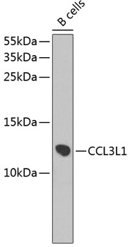 Western blot analysis of extracts of B-cell cells using CCL3L1 Polyclonal Antibody at dilution of 1:1000.