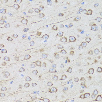 Immunohistochemistry of paraffin-embedded Mouse brain using MIP Polyclonal Antibody at dilution of  1:100 (40x lens).