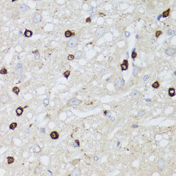 Immunohistochemistry of paraffin-embedded Rat brain using MIP Polyclonal Antibody at dilution of  1:100 (40x lens).