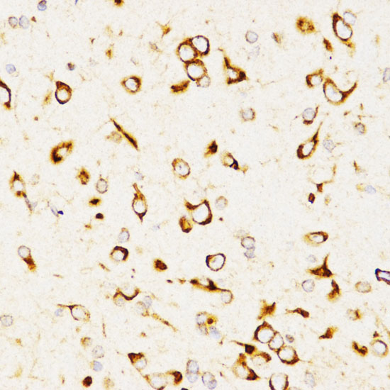 Immunohistochemistry of paraffin-embedded Rat brain using LAMP3 Polyclonal Antibody at dilution of  1:200 (40x lens).