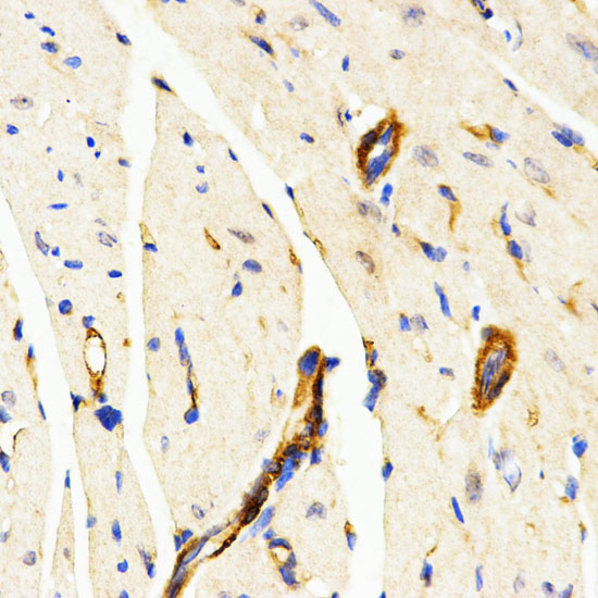 Immunohistochemistry of paraffin-embedded Mouse heart using LAMP3 Polyclonal Antibody at dilution of  1:200 (40x lens).