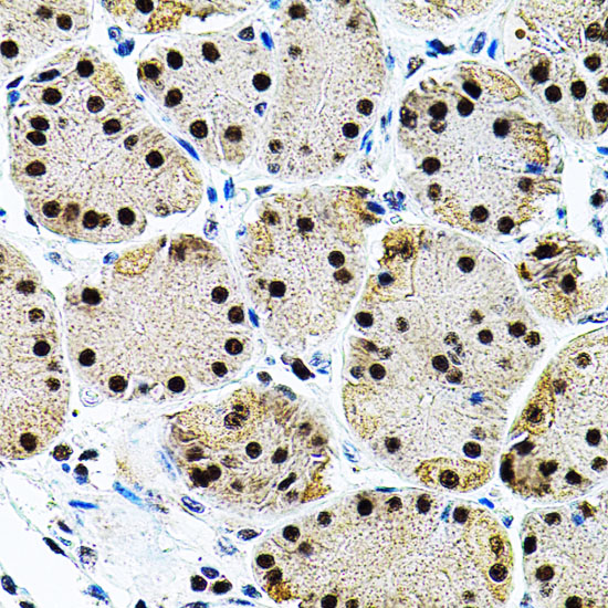 Immunohistochemistry of paraffin-embedded Human stomach using EIF4G2 Polyclonal Antibody