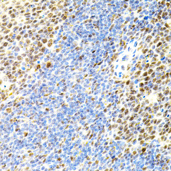 Immunohistochemistry of paraffin-embedded Mouse spleen using EIF4G2 Polyclonal Antibody