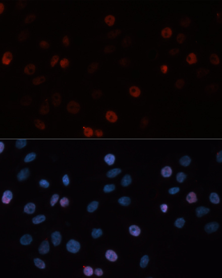 Immunofluorescence analysis of HeLa cells using DNMT3B Polyclonal Antibody at dilution of  1:100. Blue: DAPI for nuclear staining.