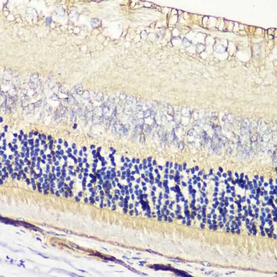 Immunohistochemistry of paraffin-embedded Rat retina using GRK1 Polyclonal Antibody at dilution of  1:200 (40x lens).