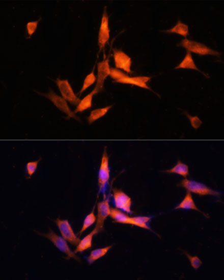 Immunofluorescence analysis of NIH-3T3 cells using MMP10 Polyclonal Antibody at dilution of  1:100 (40x lens). Blue: DAPI for nuclear staining.