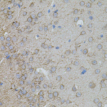 Immunohistochemistry of paraffin-embedded Mouse brain using MMP10 Polyclonal Antibody at dilution of  1:100 (40x lens).