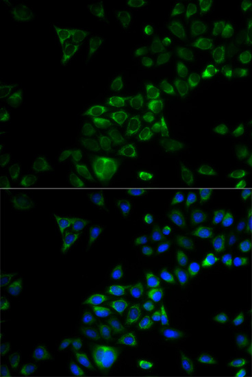 Immunofluorescence analysis of HeLa cells using TRAF3 Polyclonal Antibody