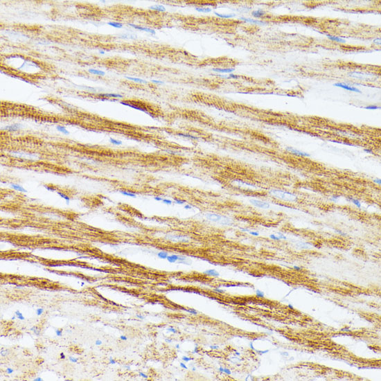 Immunohistochemistry of paraffin-embedded Rat heart using TPM2 Polyclonal Antibody at dilution of  1:100 (40x lens).