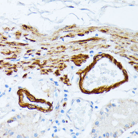 Immunohistochemistry of paraffin-embedded Human stomach using TPM2 Polyclonal Antibody at dilution of  1:100 (40x lens).