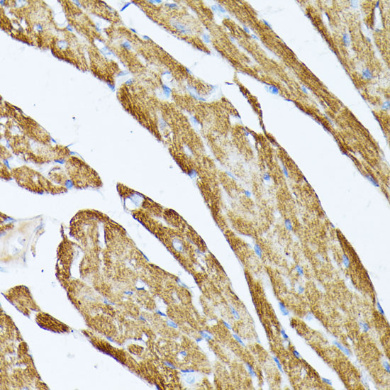 Immunohistochemistry of paraffin-embedded Mouse heart using TPM2 Polyclonal Antibody at dilution of  1:100 (40x lens).