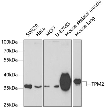 Western blot analysis of extracts of various cell lines using TPM2 Polyclonal Antibody at dilution of 1:400.