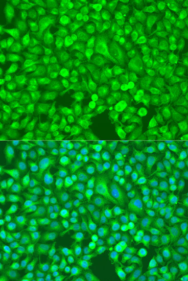 Immunofluorescence analysis of U2OS cells using NFkB p100 / p52 Polyclonal Antibody at dilution of  1:100. Blue: DAPI for nuclear staining.