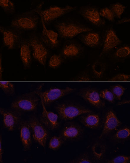 Immunofluorescence analysis of U-2 OS cells using PPP2CB Polyclonal Antibody at dilution of  1:100. Blue: DAPI for nuclear staining.