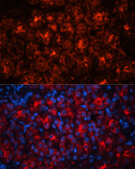 Immunofluorescence analysis of Rat kidney using LCN2 Polyclonal Antibody at dilution of  1:100. Blue: DAPI for nuclear staining.