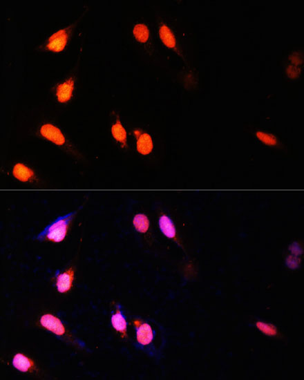 Immunofluorescence analysis of U-2 OS cells using SETD2 Polyclonal Antibody at dilution of  1:100 (40x lens). Blue: DAPI for nuclear staining.