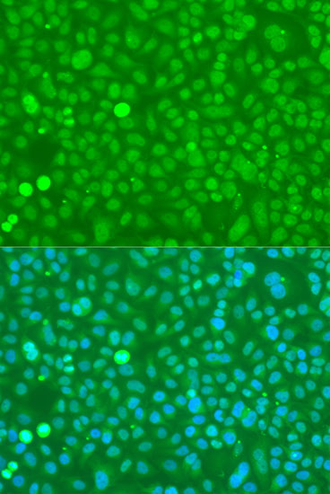 Immunofluorescence analysis of U2OS cells using UBC Polyclonal Antibody at dilution of  1:100. Blue: DAPI for nuclear staining.