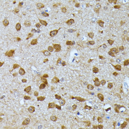 Immunohistochemistry of paraffin-embedded Mouse brain using UBC Polyclonal Antibody at dilution of  1:100 (40x lens).