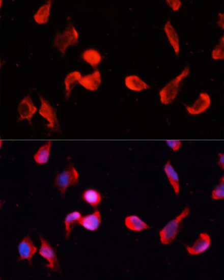 Immunofluorescence analysis of HeLa cells using CAMK2G Polyclonal Antibody at dilution of  1:100 (40x lens). Blue: DAPI for nuclear staining.