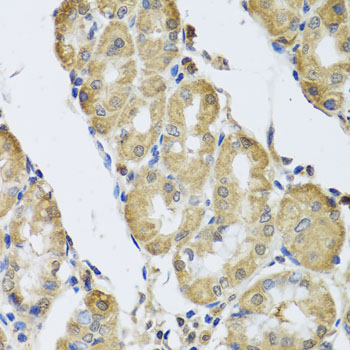 Immunohistochemistry of paraffin-embedded Human stomach using CAMK2G Polyclonal Antibody at dilution of  1:100 (40x lens).