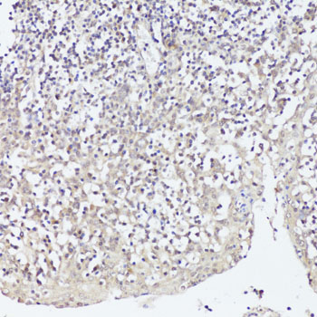 Immunohistochemistry of paraffin-embedded Human tonsil using Twist Polyclonal Antibody at dilution of  1:100 (40x lens).