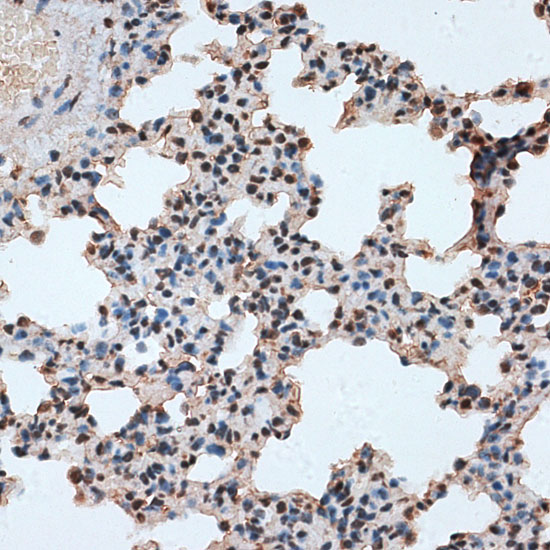 Immunohistochemistry of paraffin-embedded Rat lung using RBM17 Polyclonal Antibody at dilution of  1:100 (40x lens).