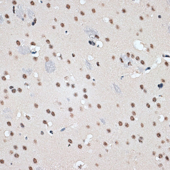 Immunohistochemistry of paraffin-embedded Mouse brain using RBM17 Polyclonal Antibody at dilution of  1:100 (40x lens).