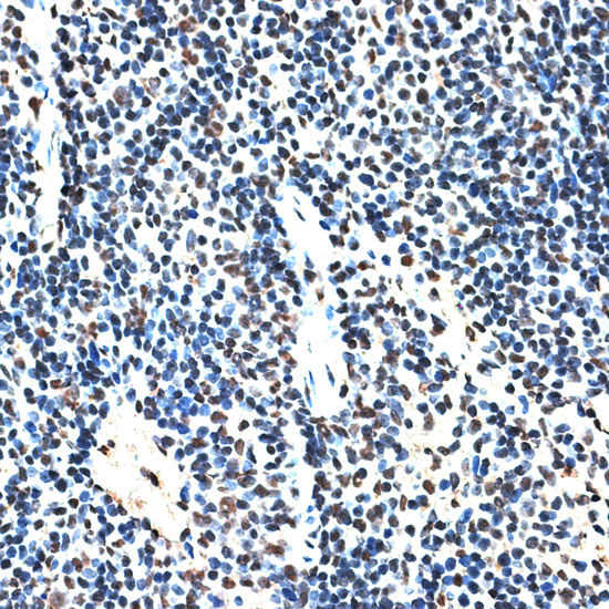 Immunohistochemistry of paraffin-embedded Mouse spleen using RBM17 Polyclonal Antibody at dilution of  1:100 (40x lens).