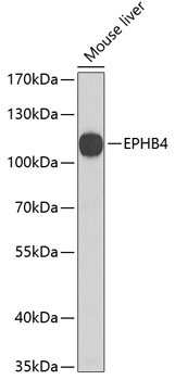 Western blot analysis of extracts of Mouse liver using EPHB4 Polyclonal Antibody at dilution of 1:1000.