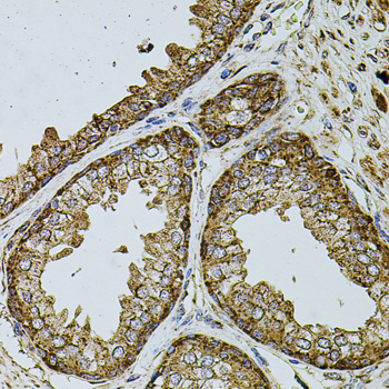 Immunohistochemistry of paraffin-embedded Human prostate using UQCRC1 Polyclonal Antibody at dilution of  1:100 (40x lens).